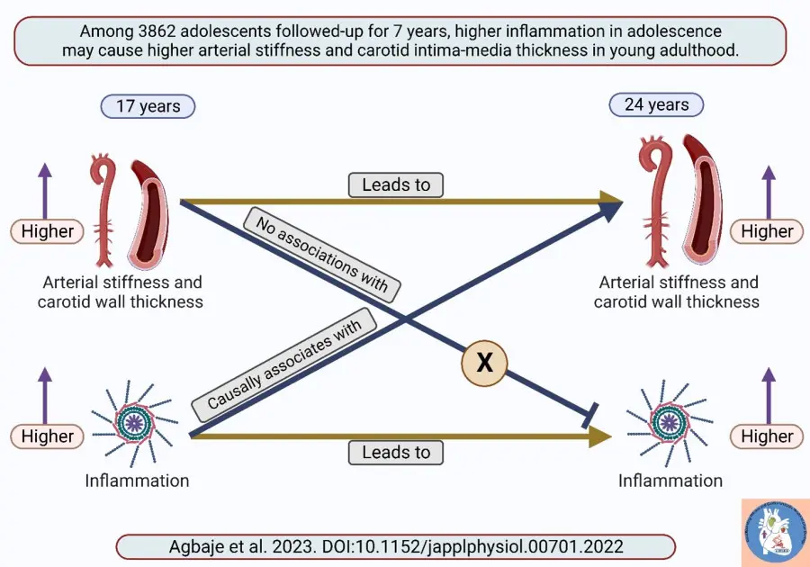 Low-grade inflammation may cause arterial stiffness and preclinical atherosclerosis in otherwise healthy adolescents